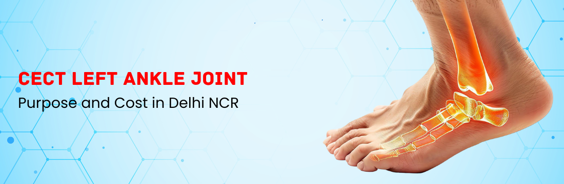 CECT Left Ankle Joint: Purpose and Cost in Delhi NCR
